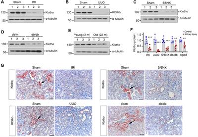 Klotho-derived peptide KP1 ameliorates SARS-CoV-2-associated acute kidney injury